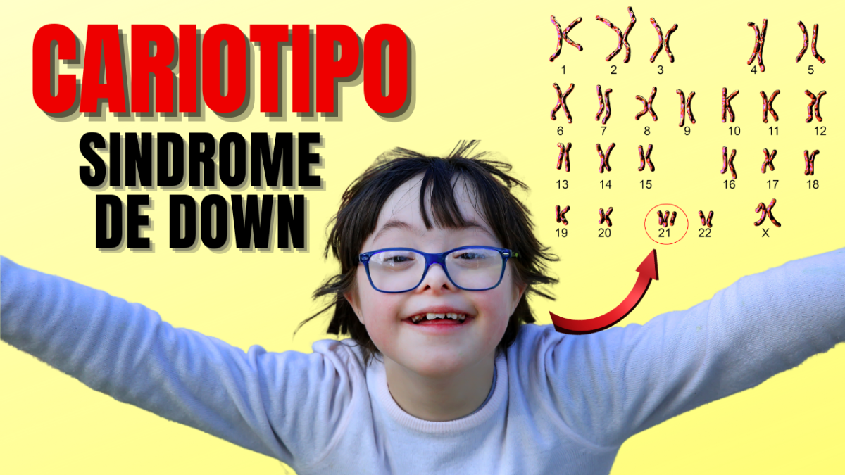 🔴CARIOTIPO EN EL SINDROME DE DOWN☺️ - Chromosomes and Karyotypes of Down Syndrom